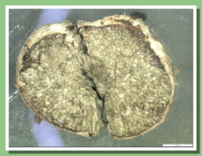 Hysterangium nephriticum01.jpg