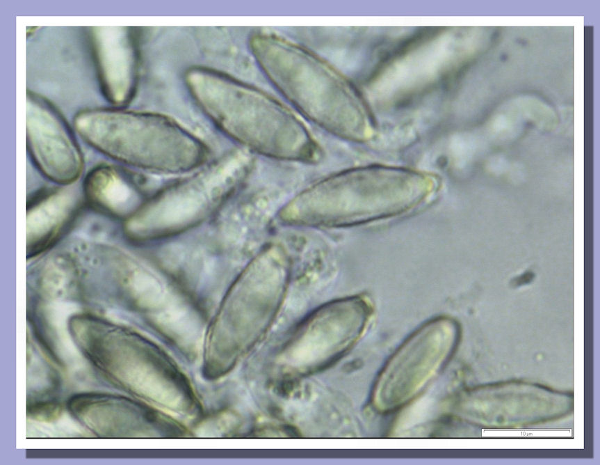 Hysterangium nephriticum close up
